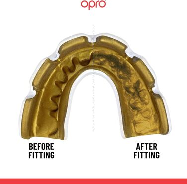 Капа OPRO Instant Custom-Fit Braces, виготовлена стоматологами, для максимального комфорту, захисту та прилягання. Капи для регбі, боксу, хокею, ММА, лакросу та єдиноборств білий/золотий