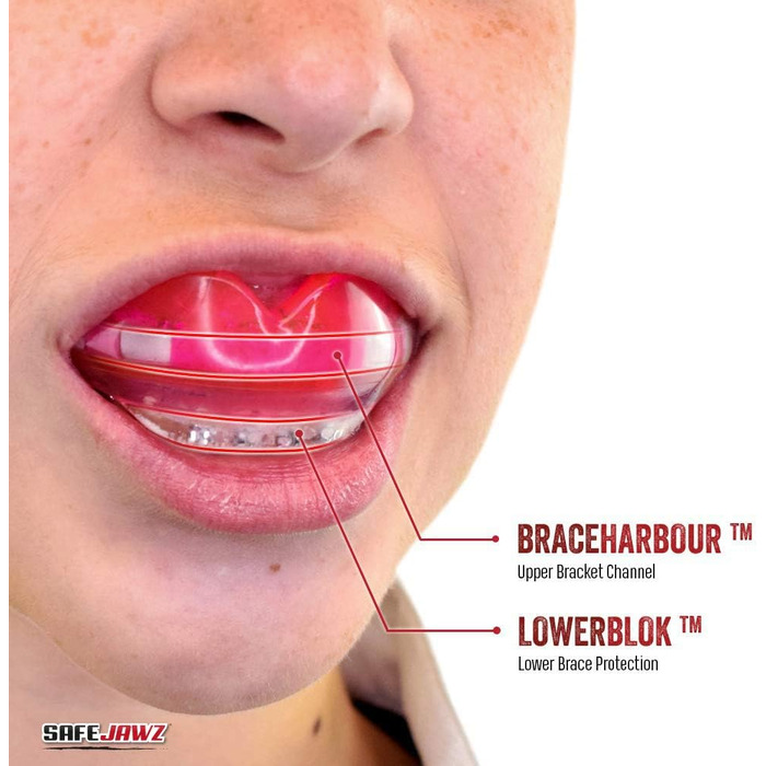 Капа SAFEJAWZ для брекетів - універсальний розмір, повноконтактні види спорту